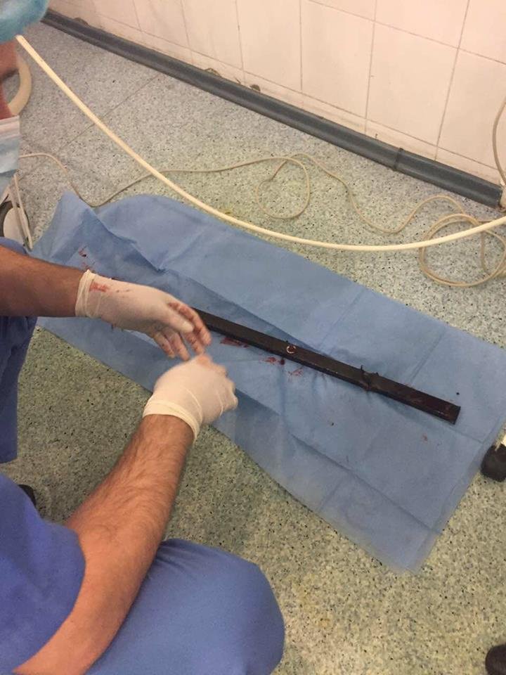 Как в "Пункте назначения": в Днепре спасали парня, которого проткнула железная труба (ФОТО) 3