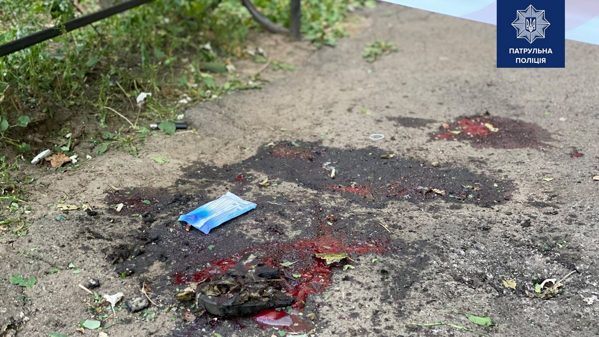 В Кривом Роге из-за взрыва гранаты пострадали трое полицейских: открыто уголовное производство 3