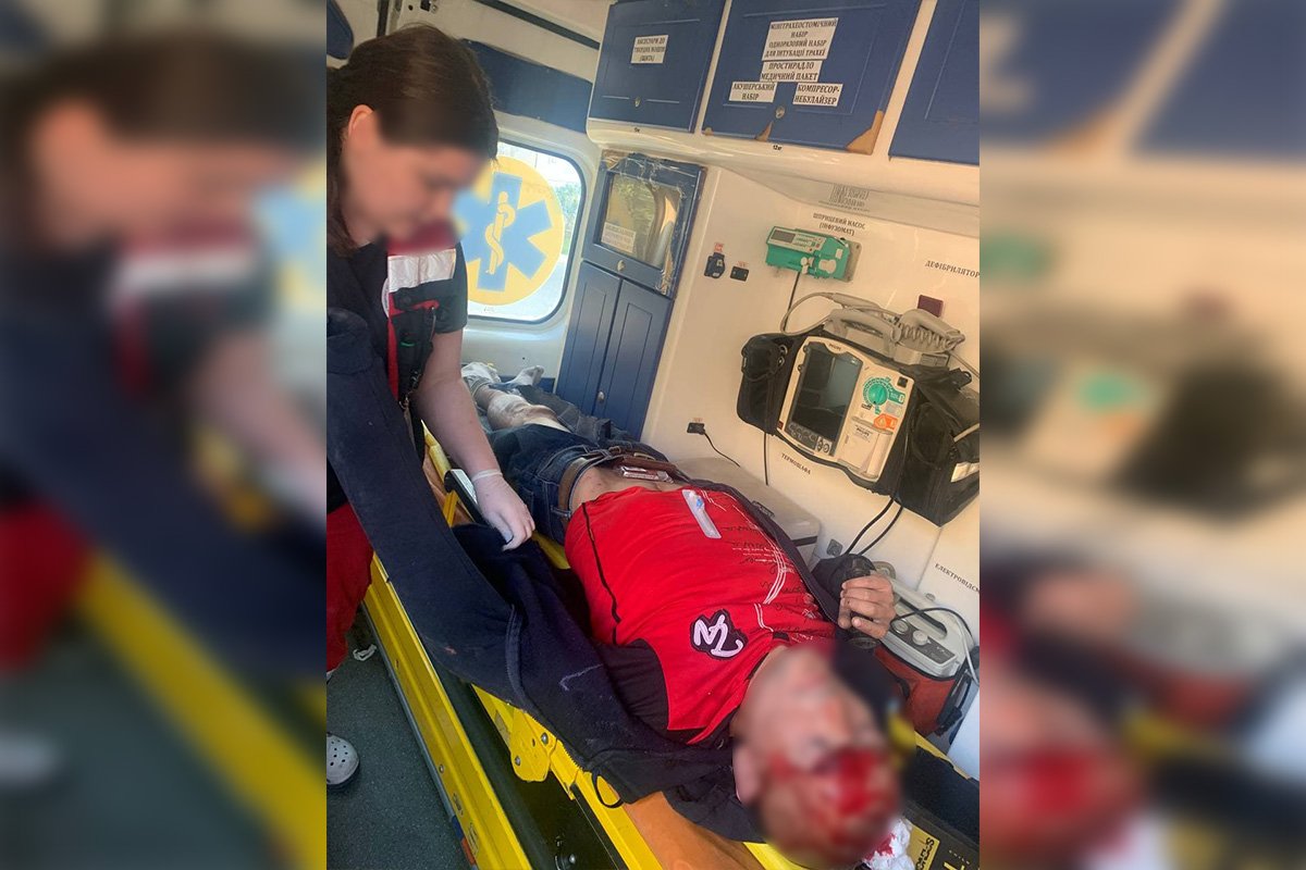 У мужчины открытая черепно-мозговая травма У мужчины открытая черепно-мозговая травма