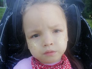 Эпилепсия, бронхолегочная дисплазия и опухоль мозга: каким детям в Днепре нужна помощь 4