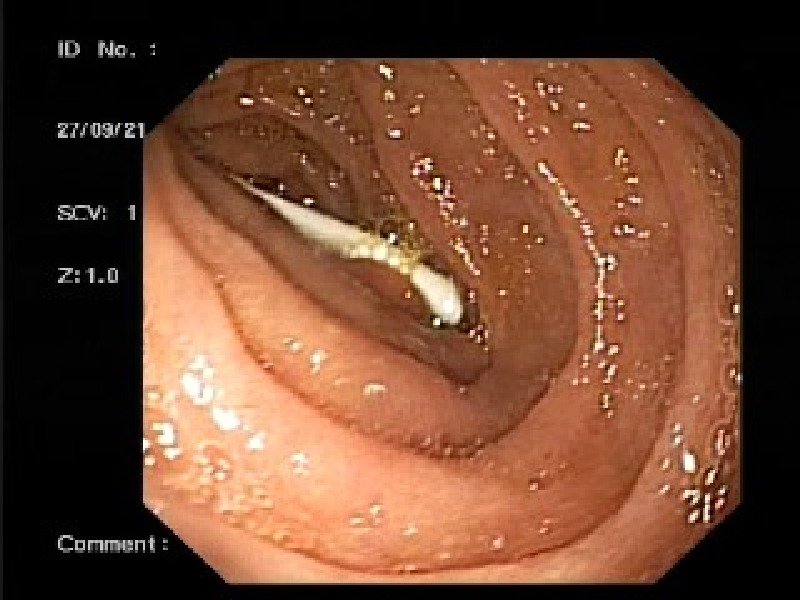 Здоровью подростка ничего не угрожает