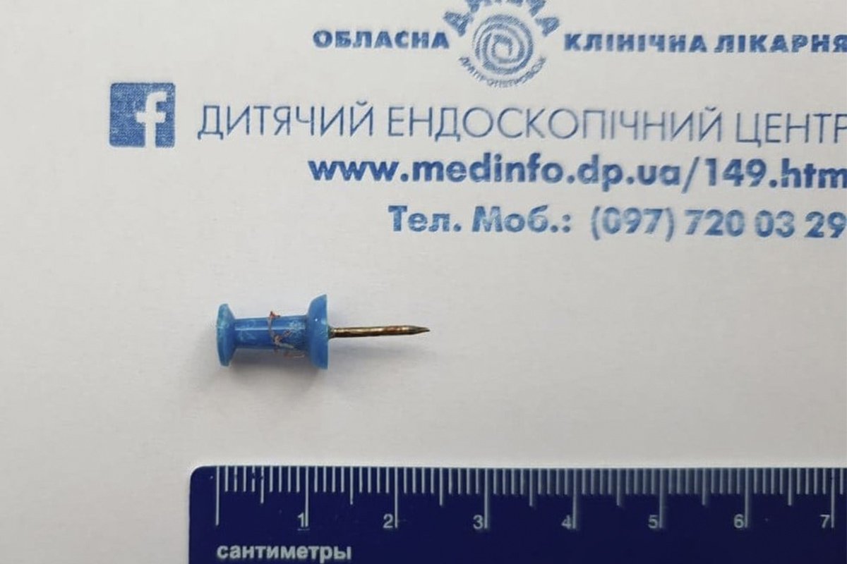 В Днепре 7-летний ребенок вдохнул канцелярскую кнопку
