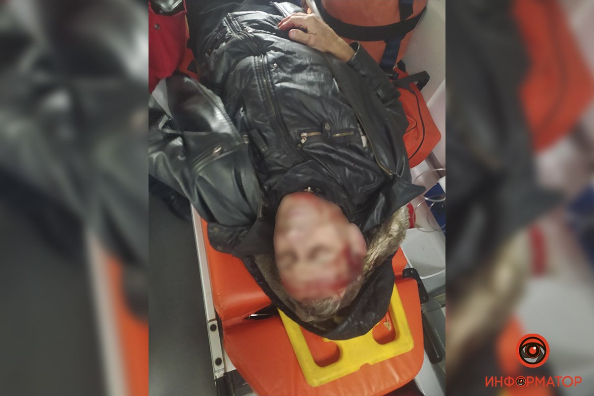Пострадавшего госпитализировали