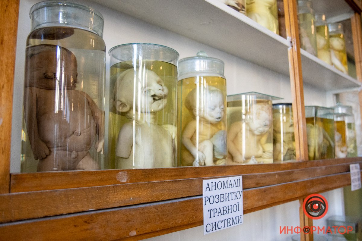 Стенд с аномалиями развития плода Стенд с аномалиями развития плода