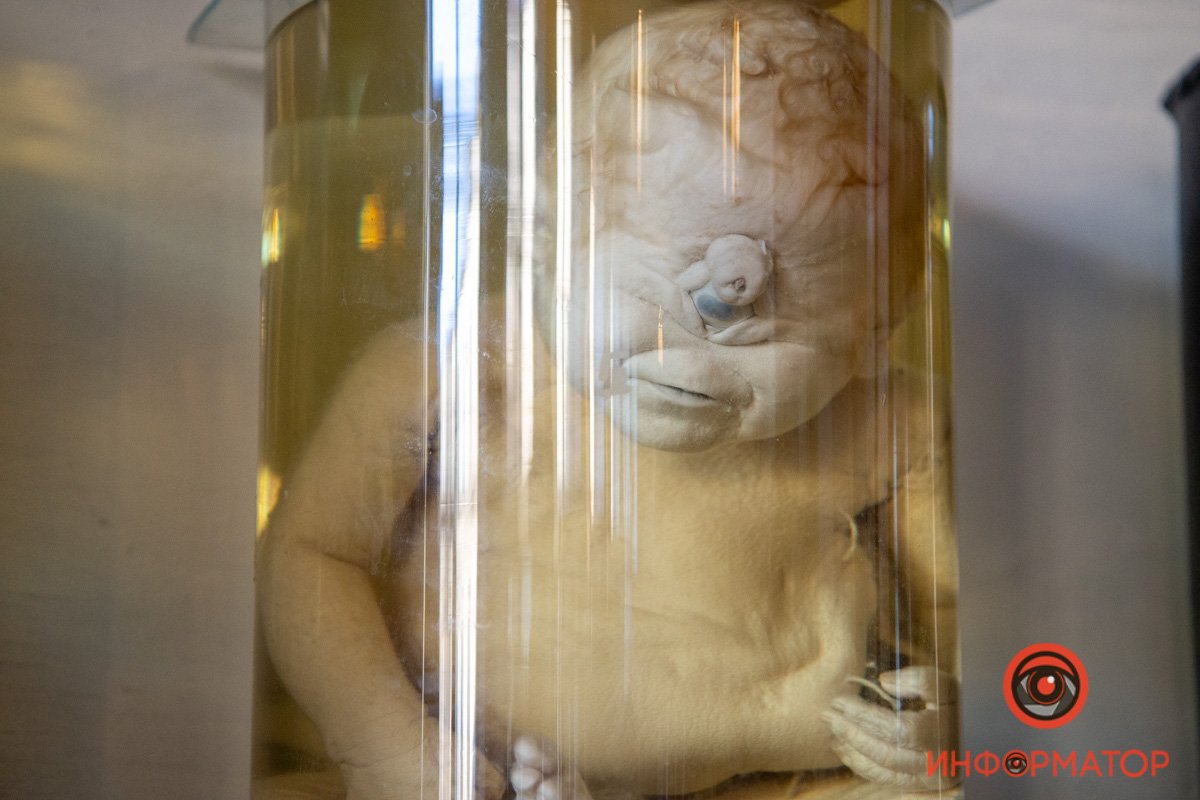 Циклопия Циклопия