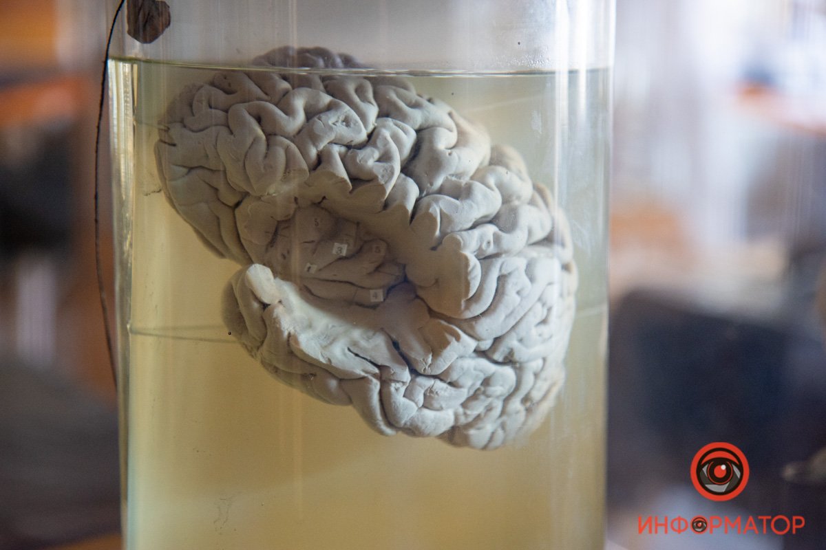 В музее представлено множество органов и тканей В музее представлено множество органов и тканей