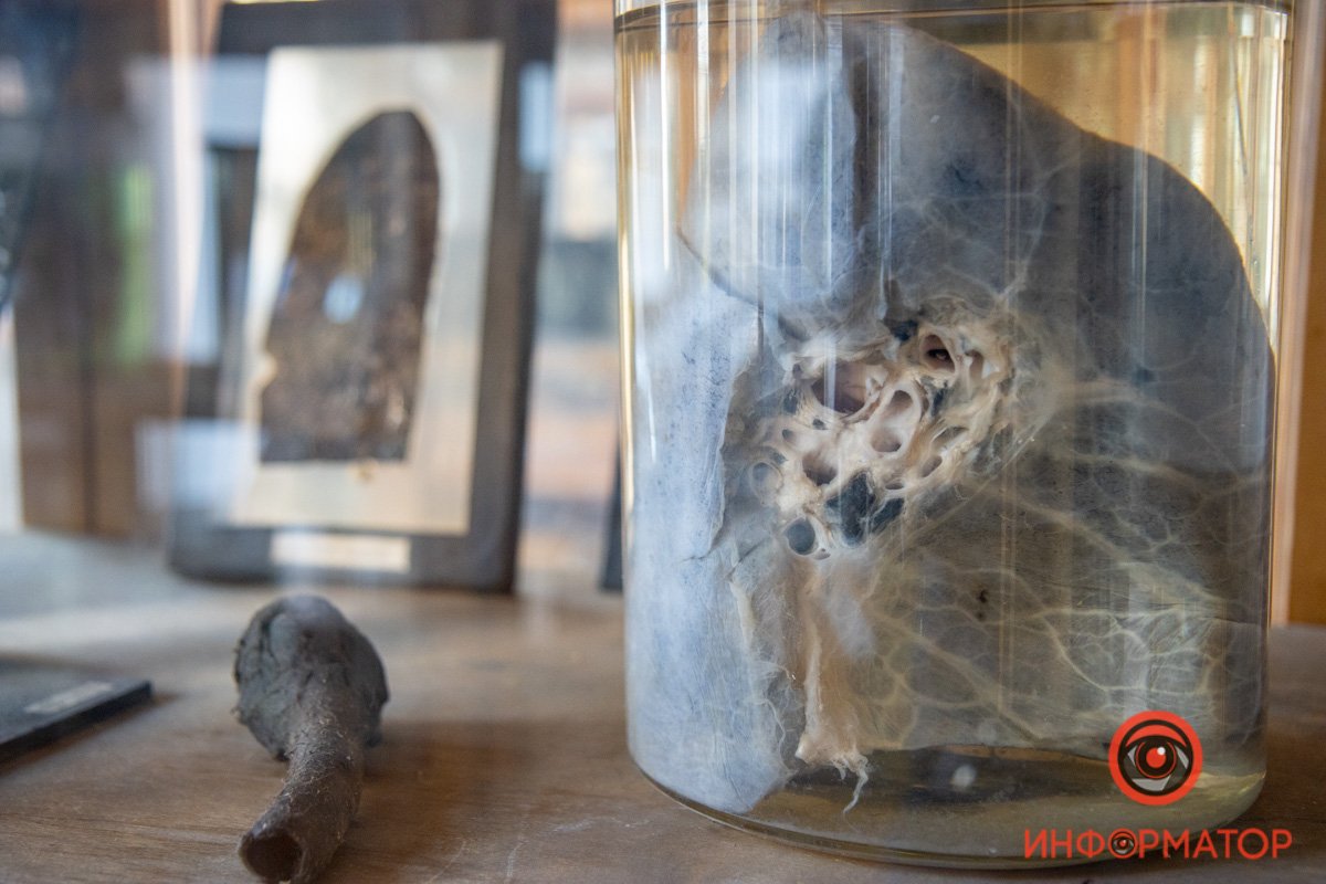 К каким органическим поражениям приводит курение К каким органическим поражениям приводит курение