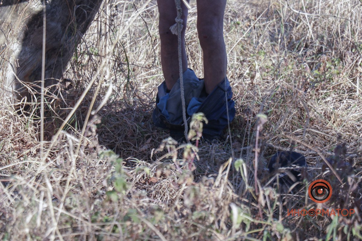 На теле мужчина приспущены штаны