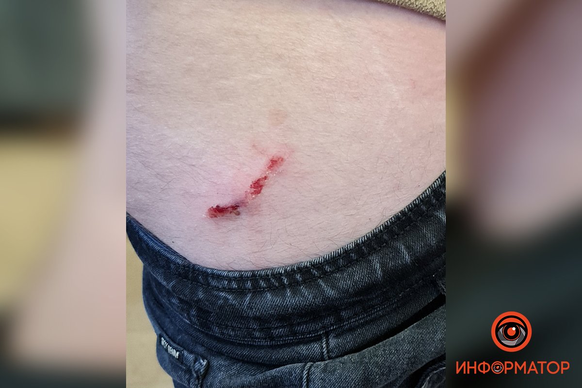 И не только И не только