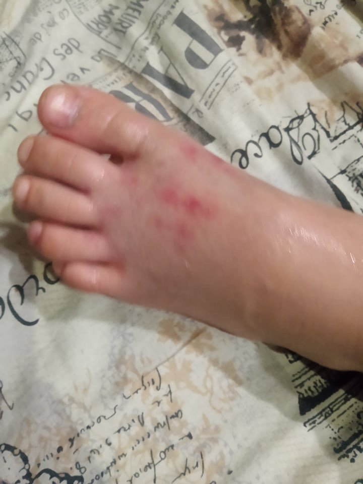 В Днепре на Каруны сбили 10-летнюю девочку на переходе и скрылись: поиск свидетелей 2