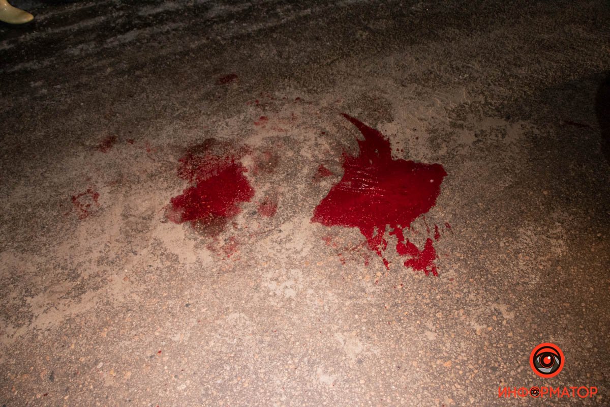 В Днепре на Батумской Daewoo Lanos сбил мужчину 5