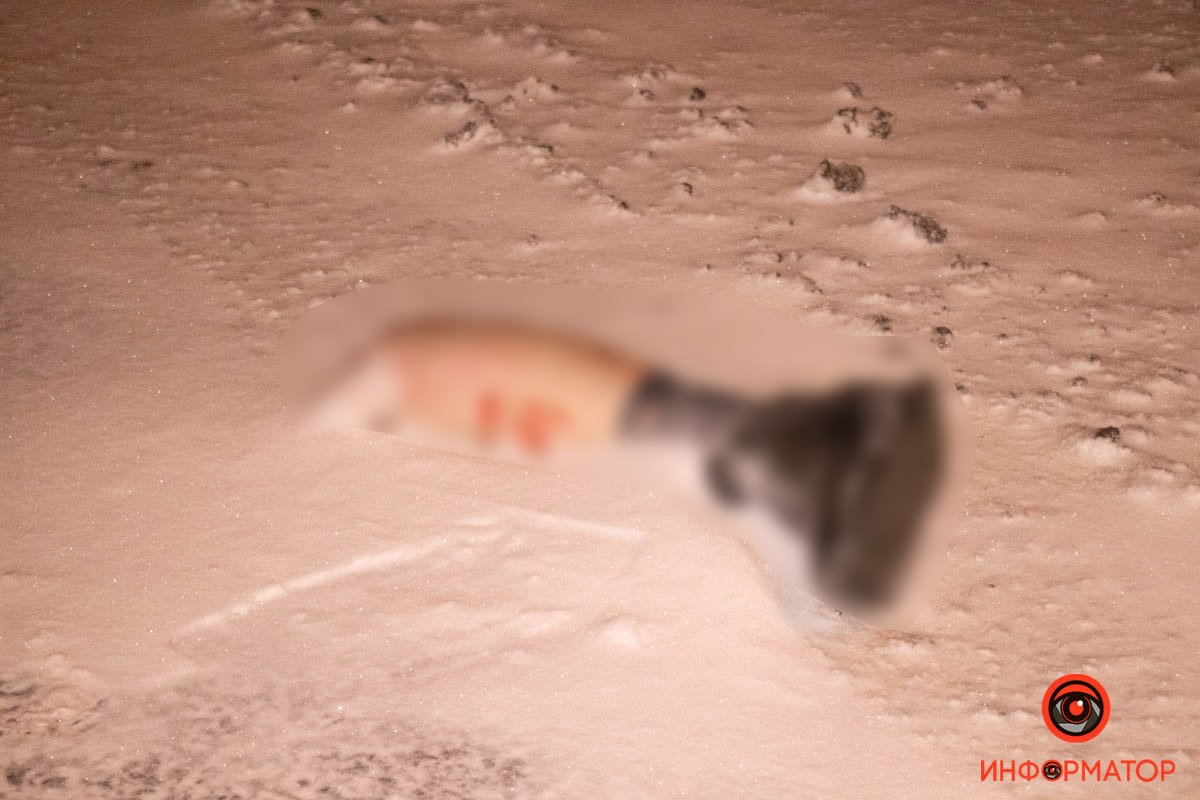 Мужчине оторвало ногу Мужчине оторвало ногу