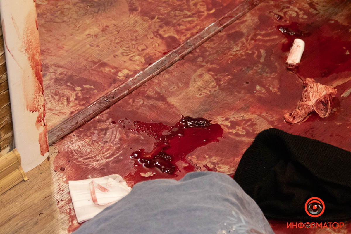 В Днепре парень ударил девушку ножом из-за расставания: фото с места 1