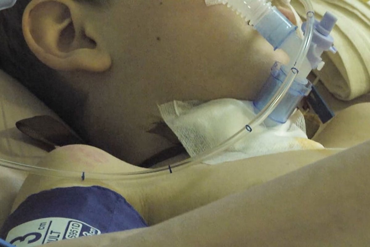 В больницах Днепропетровской области спасают людей, которые пострадали в результате вражеского ракетного удара по вокзалу Краматорска В больницах Днепропетровской области спасают людей, которые пострадали в результате вражеского ракетного удара по вокзалу Краматорска