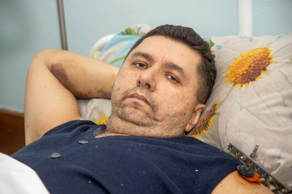 У Евгения - ранения руки и ноги У Евгения - ранения руки и ноги