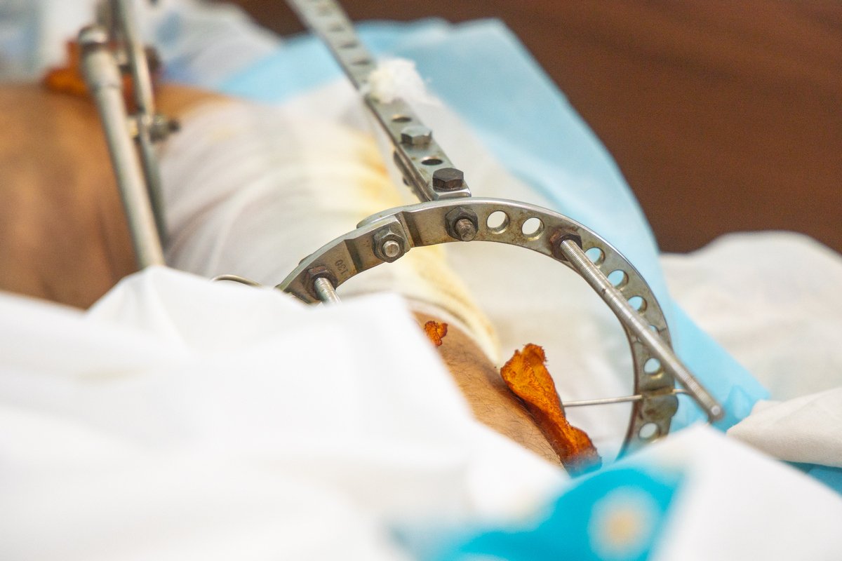 В больницах Днепра и области остаются 19 пострадавших при атаке вокзала Краматорска В больницах Днепра и области остаются 19 пострадавших при атаке вокзала Краматорска