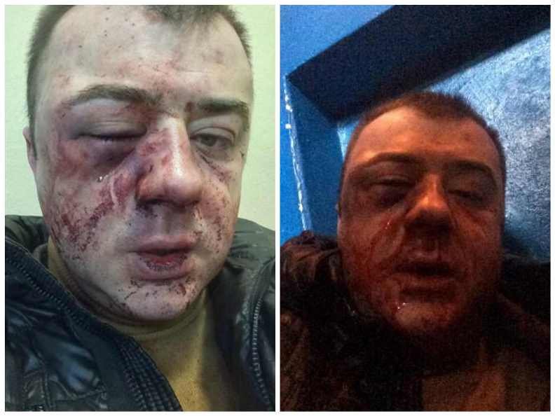 В Днепре известного юриста избили за его профессиональную деятельность (ФОТО) 1