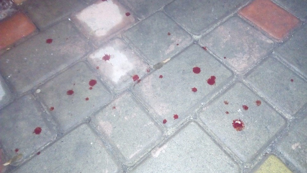 В Днепре в кафе Учан Су стреляли из травмата: есть пострадавшие (ФОТО, ПОДРОБНОСТИ) 3