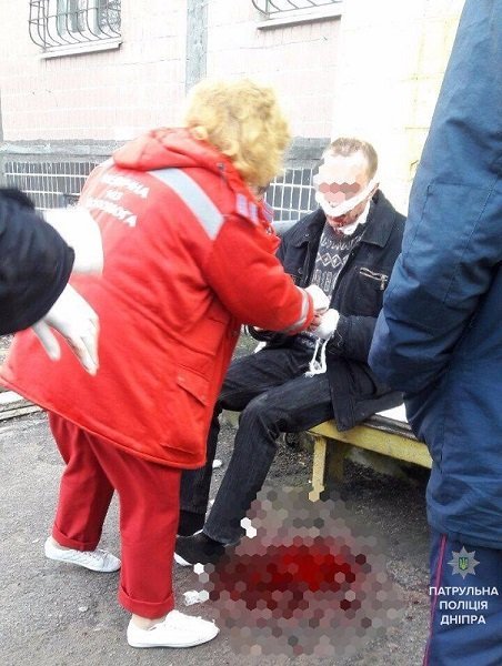 В Днепре отчим порезал мужчине руки и шею 1