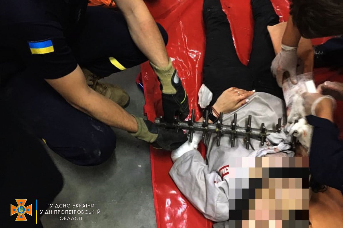 В Днепре на Океанской 27-летняя женщина застряла рукой в кондитерском станке 1