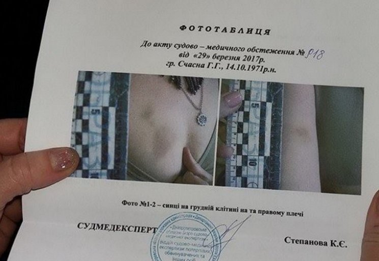 Языковой скандал не утихает: продавец, избившая вдову бойца АТО, может "сесть" на 5 лет 1