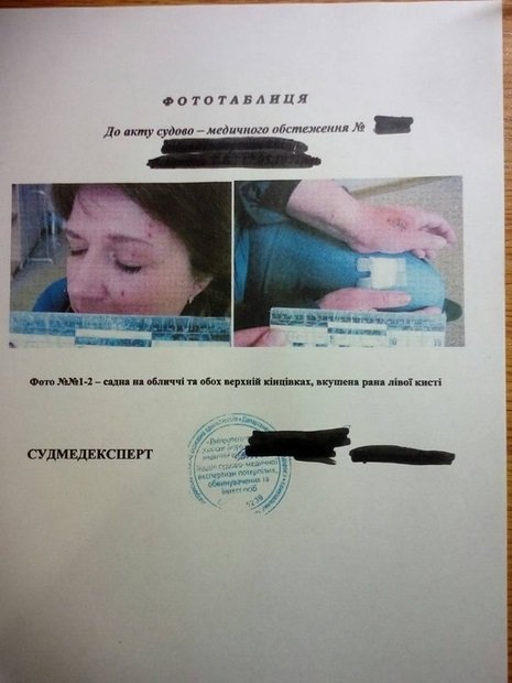 Языковой скандал не утихает: продавец, избившая вдову бойца АТО, может "сесть" на 5 лет 2