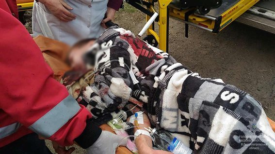 В Днепропетровской области мальчику перерезали горло: ребенок в реанимации 2