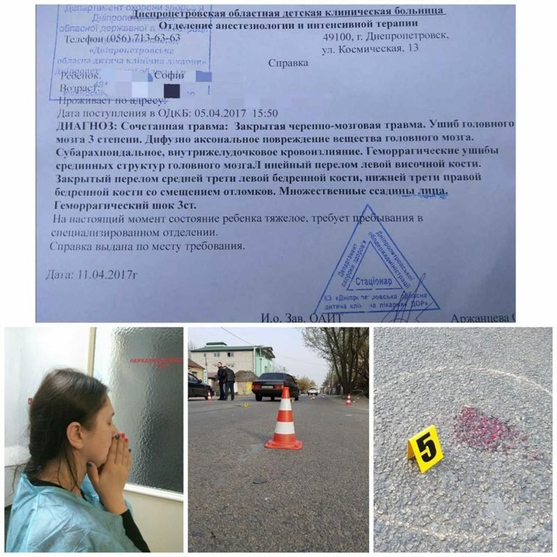 В Днепре пострадавшая в ДТП школьница вышла из комы 1