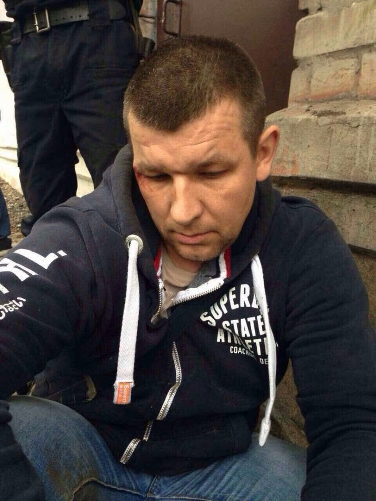 Под Днепром личные охранники Яроша прострелили ноги таксисту 4