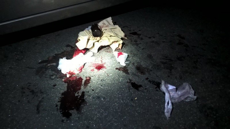 ДТП на Мануйловском проспекте: Daewoo Lanos столкнулся лоб в лоб с Chevrolet 5