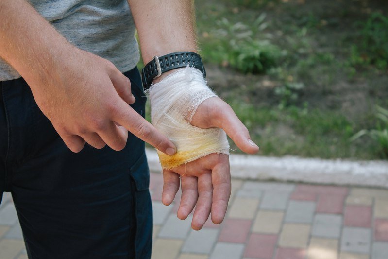 Как чувствуют себя патрульные, на которых натравили собаку 1