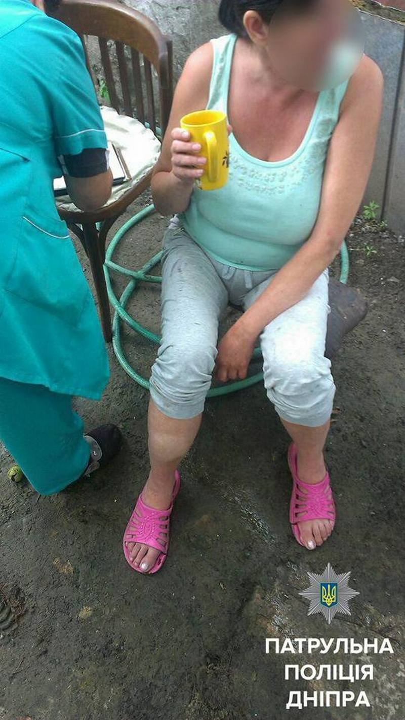Крики о помощи и сломанная нога: в Днепре патрульные спасли женщину из колодца 1