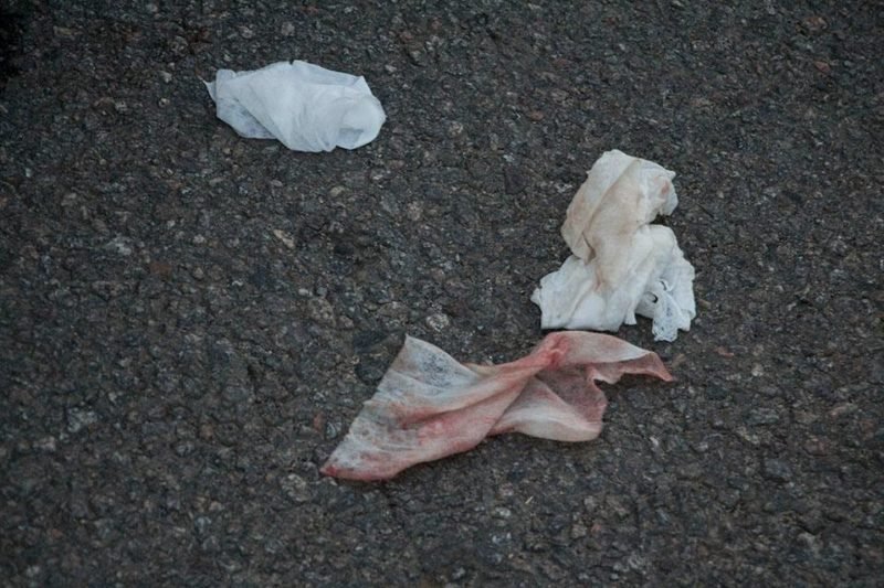 ДТП проспекте Богдана Хмельницкого: Skoda сбила 16-летнюю девочку 4