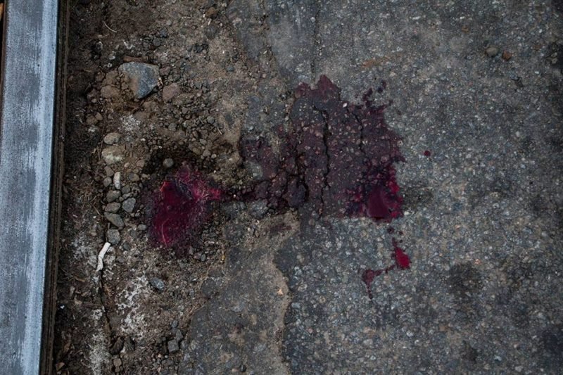 ДТП проспекте Богдана Хмельницкого: Skoda сбила 16-летнюю девочку 5