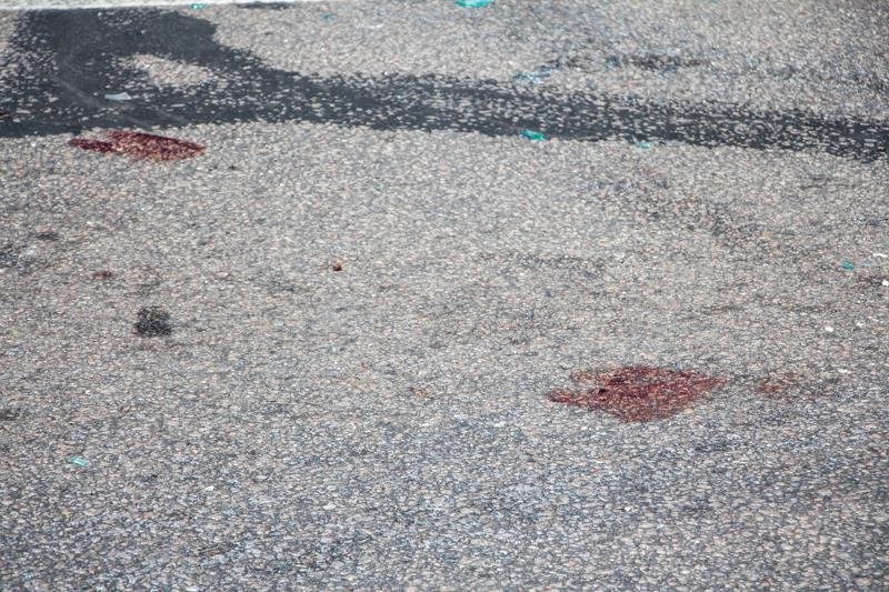 В Днепре возле Dafi ВАЗ сбил женщину на пешеходном переходе 6