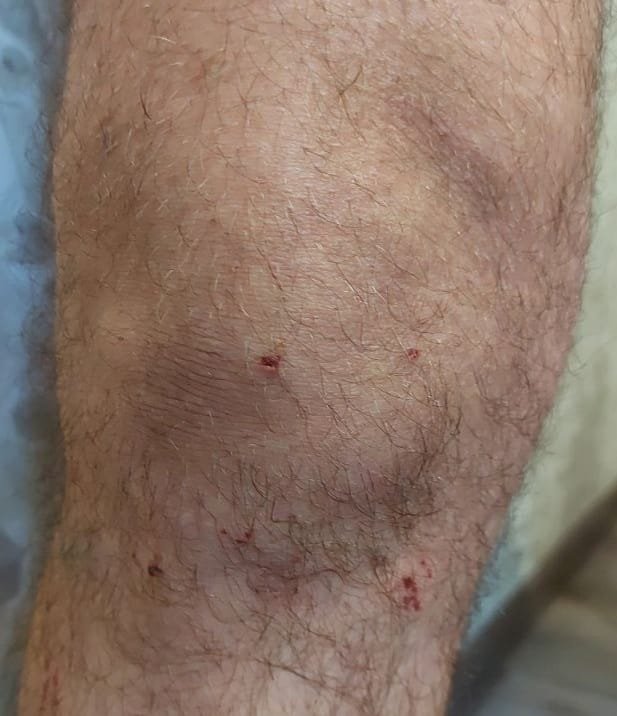 Травма фельдшера