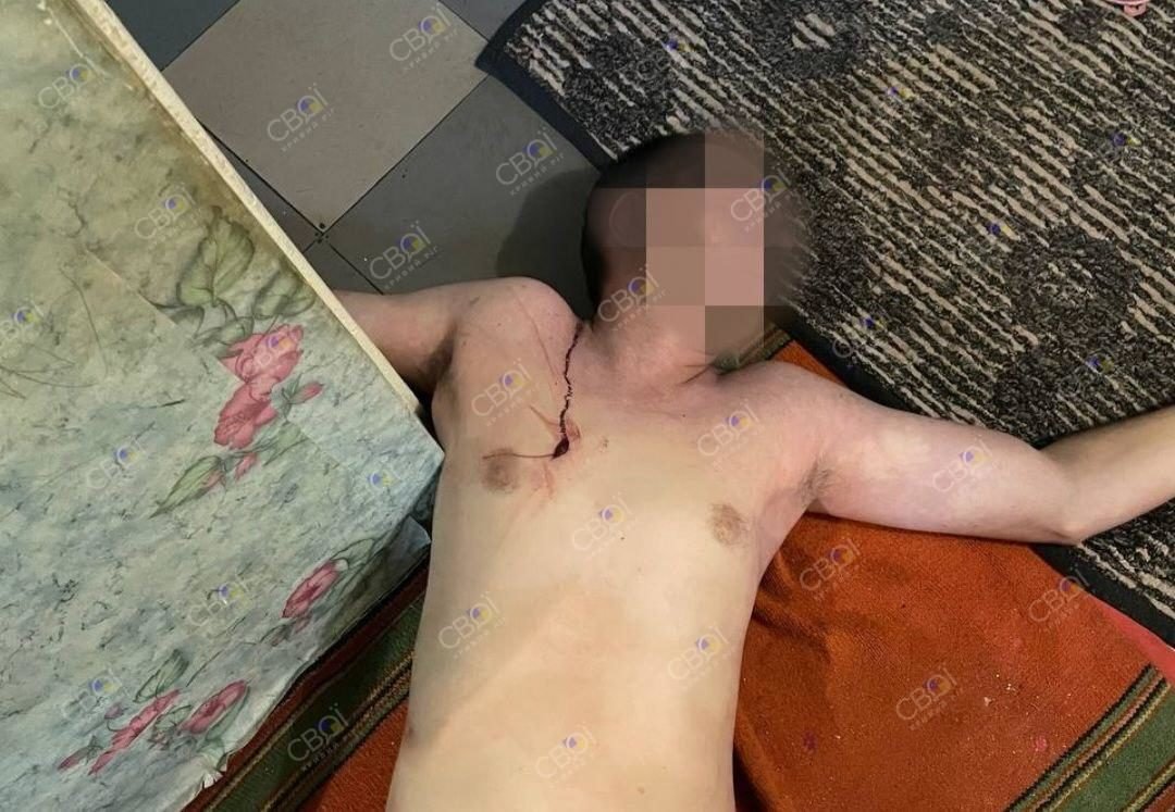 У Кривому Розі 28-річна жінка вдарила ножем у серце свого коханого 1