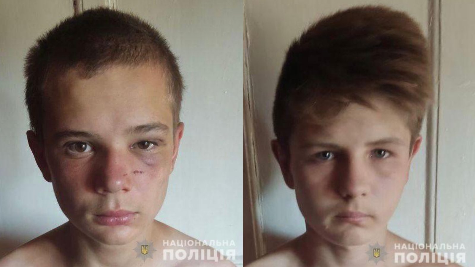 У Дніпрі з лікарні втекли 15 та 16-річний хлопчики: потрібна допомога свідків