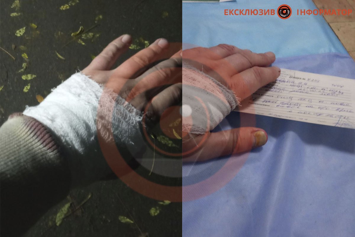 Потрапив до лікарні з ножовим пораненням Потрапив до лікарні з ножовим пораненням