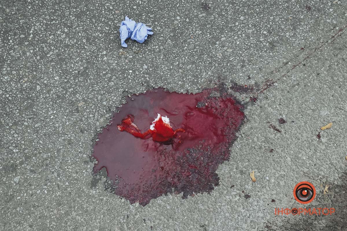 Збитого чоловіка забрала швидка Збитого чоловіка забрала швидка