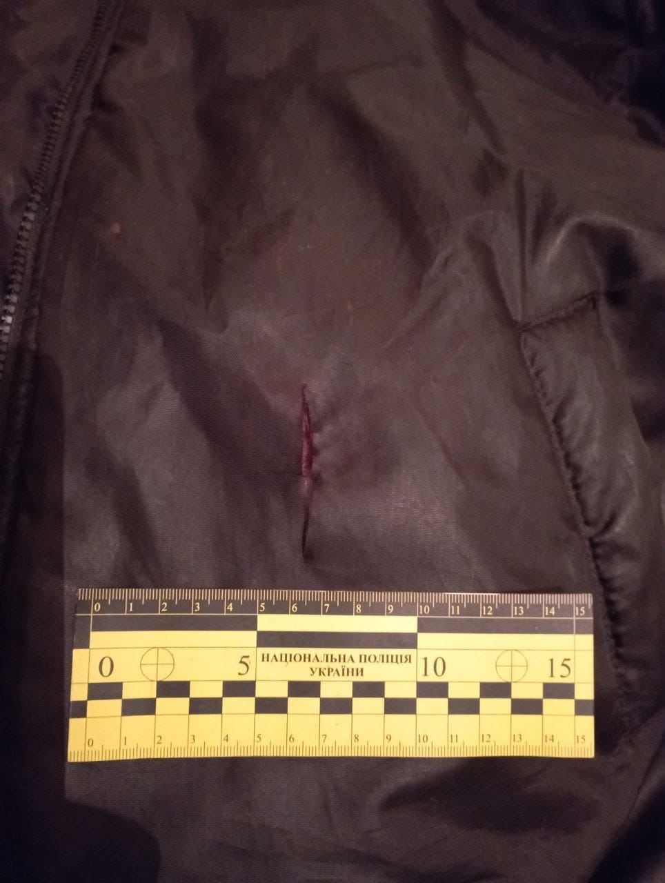 Чоловіка доставили у лікарню