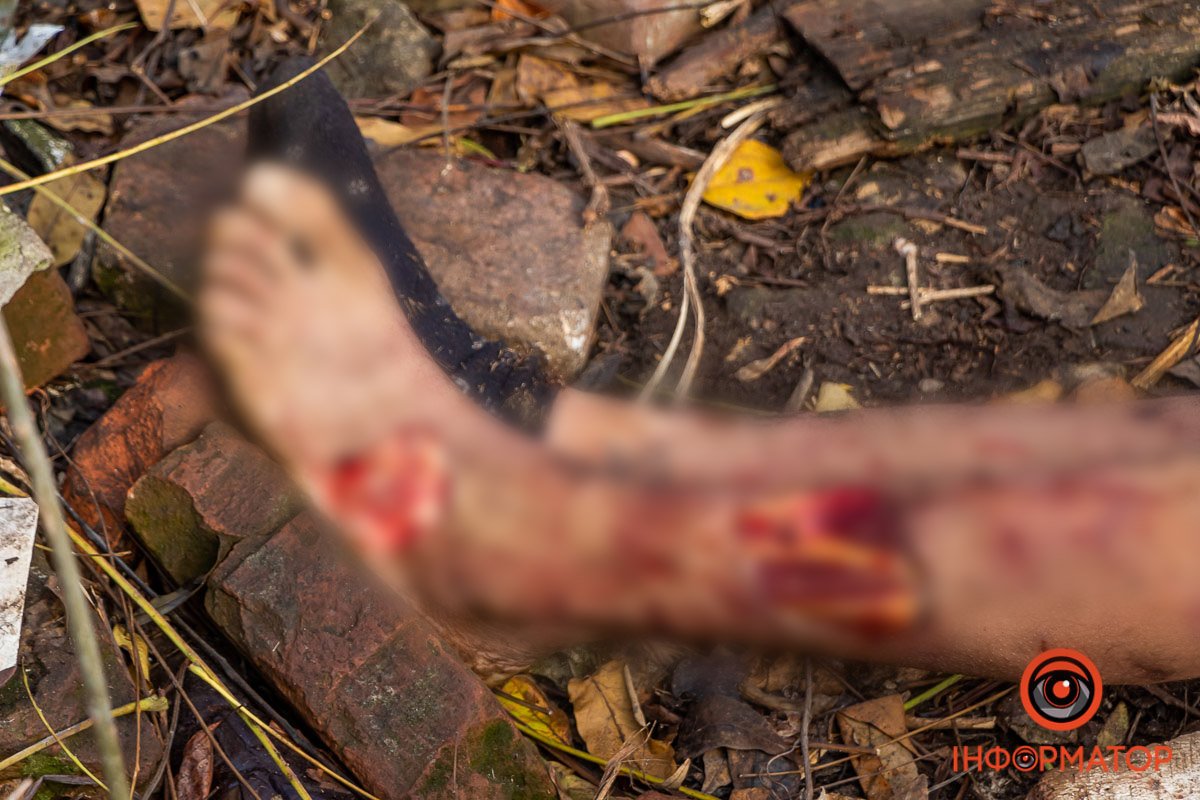 На трупі виявили сліди від укусів тварин На трупі виявили сліди від укусів тварин