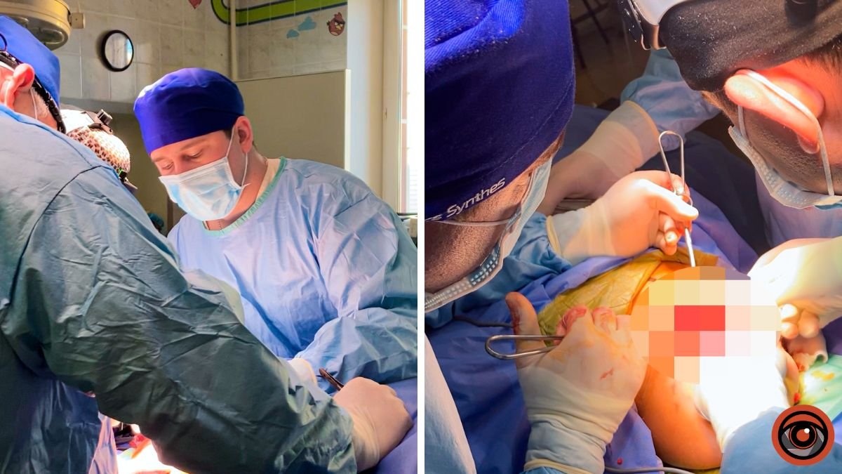 Медики в Днепре провели уникальную операцию по устранению фантомных болей