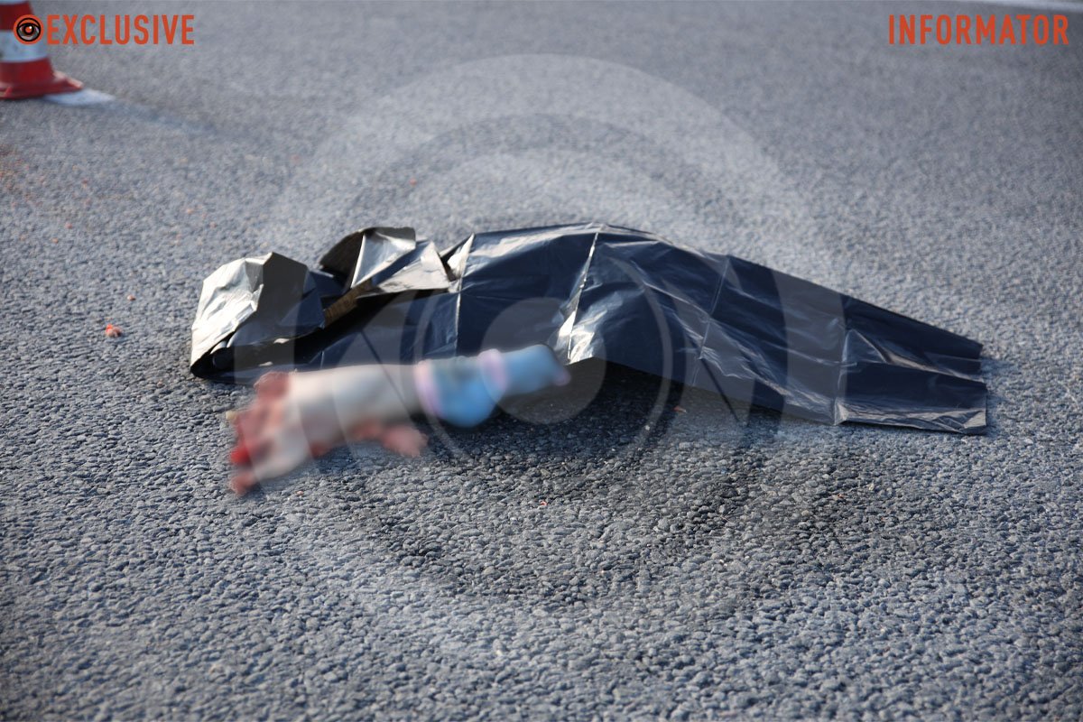 Відірвана нога