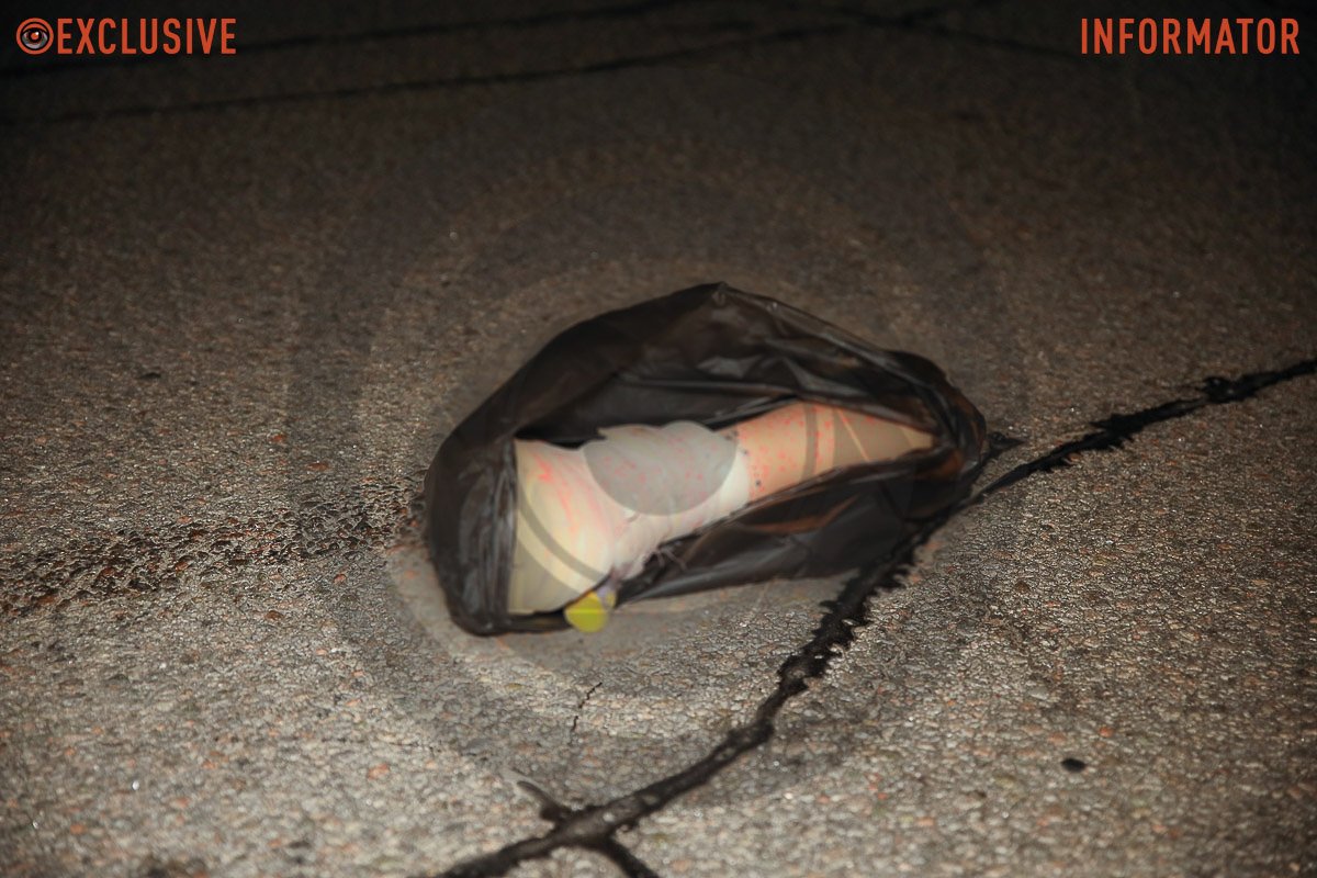 Жінці відірвало ногу