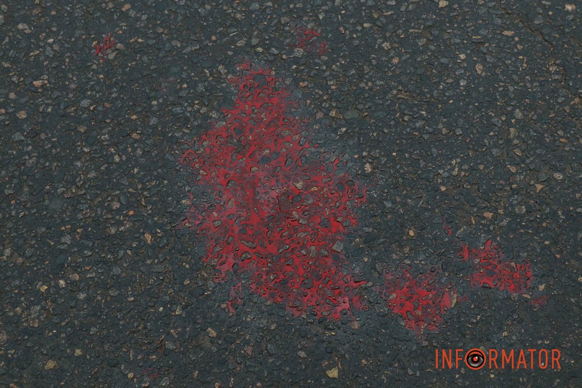 Пішохід отримав травми 