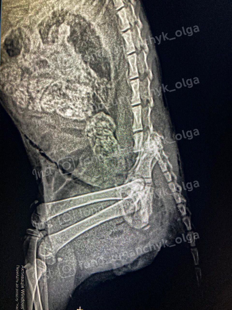 Переламаний хребет