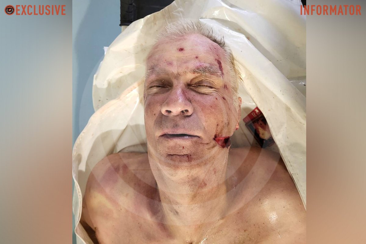 Допоможіть встановити особу чоловіка