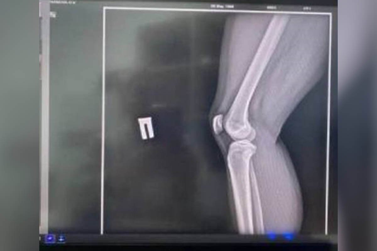 У Дніпрі посварились двоє володарів собак