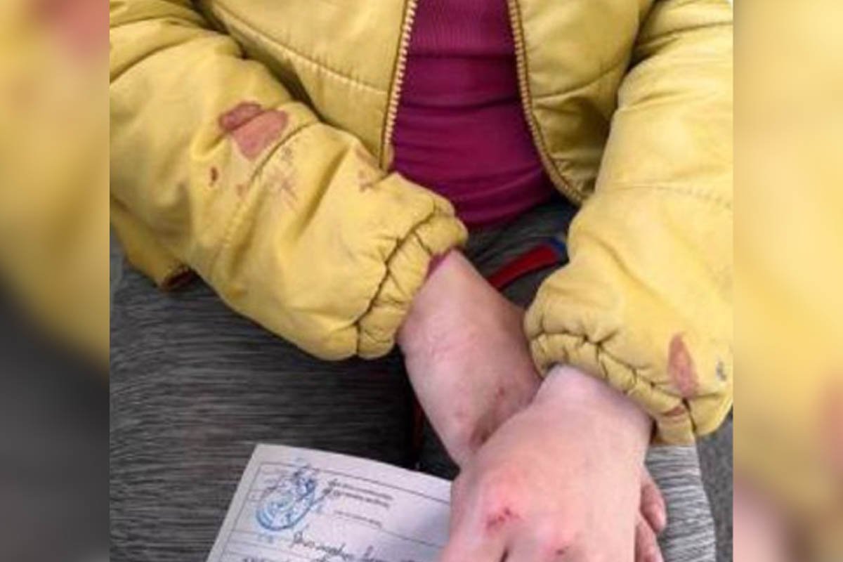 Поліція відкрила кримінальне провадження 